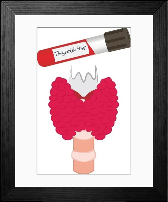 Framed Print : Thyroid test tube vector illustration diagnosis technology Framed Print : Thyroid test tube vector illustration diagnosis technology