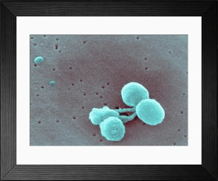 Framed Print : Scanning electron micrograph Streptococcus pneumoniae Framed Print : Scanning electron micrograph Streptococcus pneumoniae