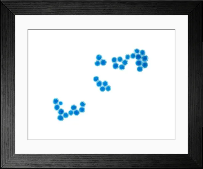 Framed Print : Roquefort cheese mold (Penicillium roqueforti) spores under the microscope Framed Print : Roquefort cheese mold (Penicillium roqueforti) spores under the microscope