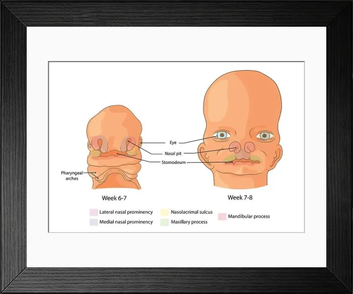 Framed Print : Embryological development of the face weeks 6-8 Framed Print : Embryological development of the face weeks 6-8