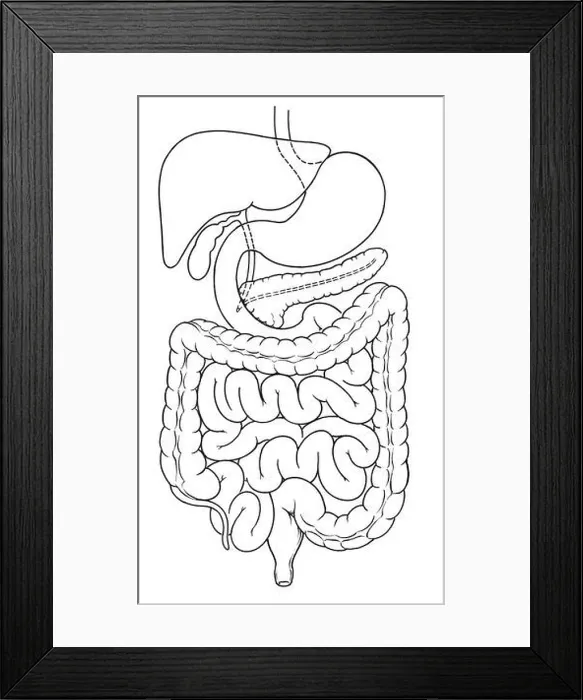 Framed Print : Illustration of Abdomen Framed Print : Illustration of Abdomen