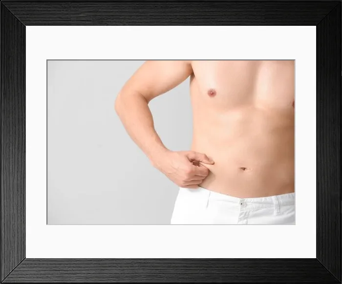 Framed Print : Young man touching his belly fat on light background. Plastic surgery concept Framed Print : Young man touching his belly fat on light background. Plastic surgery concept