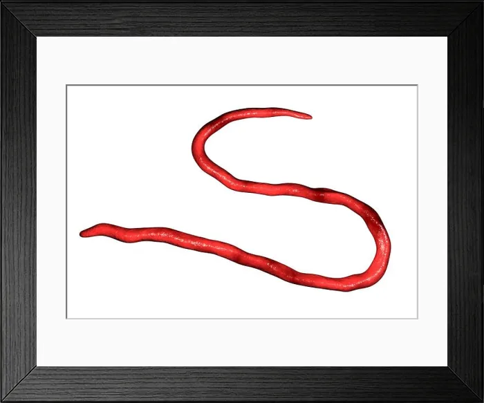 Framed Print : Onchocerca volvulus parasitic worm, computer illustration. O. volvulus is the causative agent of onchocerciasis or river blindness Framed Print : Onchocerca volvulus parasitic worm, computer illustration. O. volvulus is the causative agent of onchocerciasis or river blindness