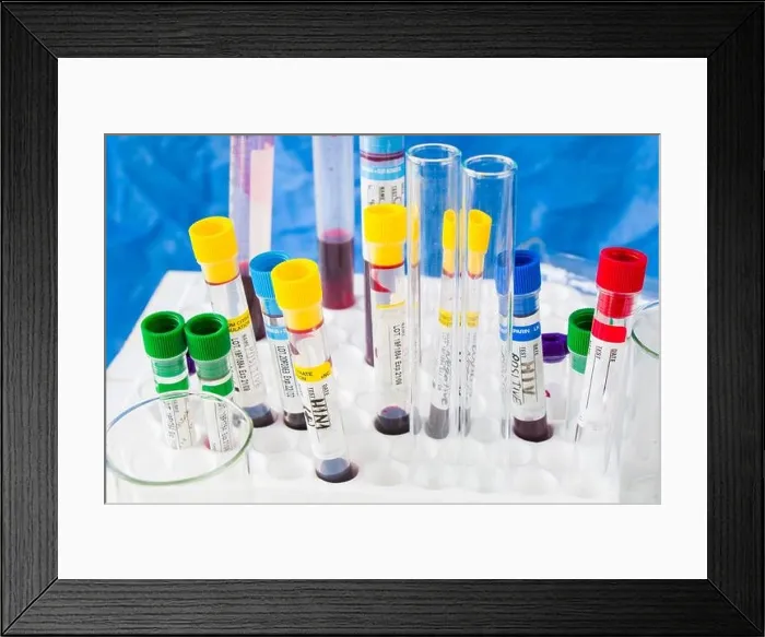 Framed Print : Laboratory table, blood test tube samples and glassware with liquid chemical elements Framed Print : Laboratory table, blood test tube samples and glassware with liquid chemical elements