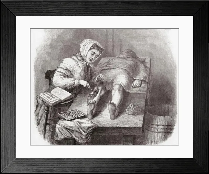 Framed Print : A student dissecting a leg at the Medical College for Women on East Twelfth Street and Second Avenue, New York, USA Framed Print : A student dissecting a leg at the Medical College for Women on East Twelfth Street and Second Avenue, New York, USA