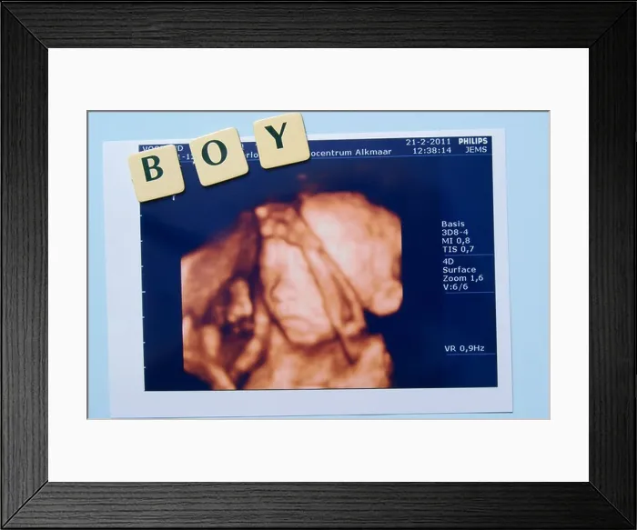 Framed Print : Baby Ultrasound, it is a boy Framed Print : Baby Ultrasound, it is a boy