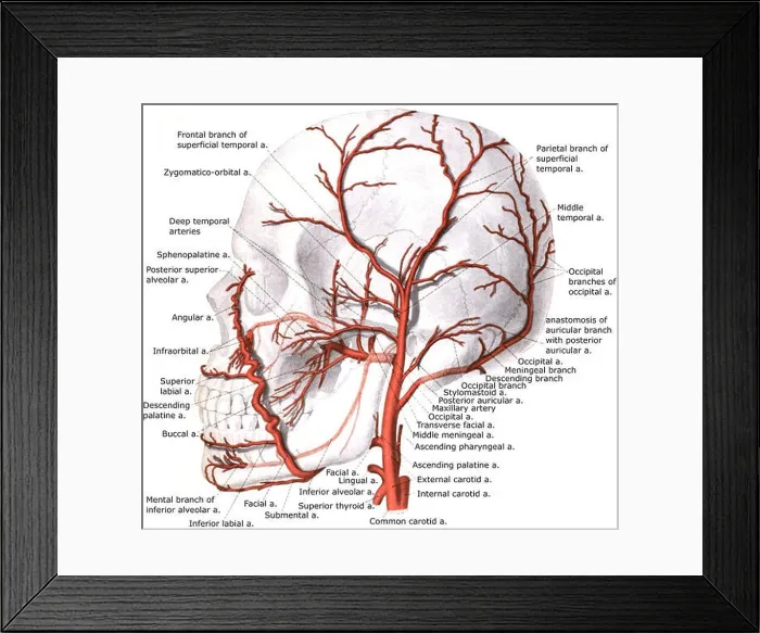 Framed Print : External carotid artery with branches Framed Print : External carotid artery with branches
