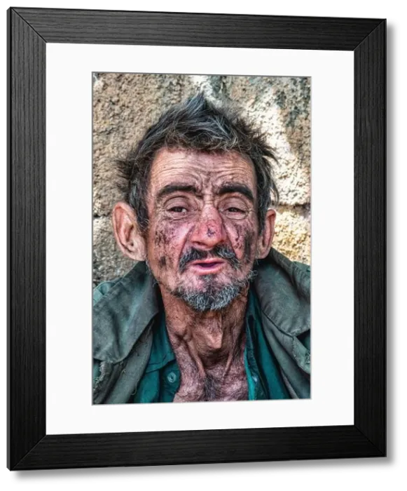 Framed Print : Black homeless man with a dirty appearance and a thoughtful look - poverty and social issues concept