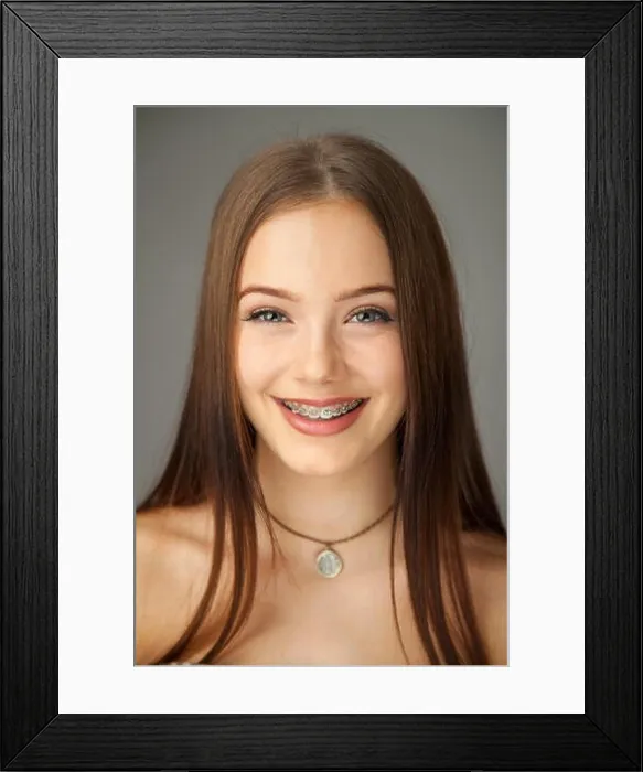 Framed Print : Portrait of a pretty fifteen year old girl wearing braces Framed Print : Portrait of a pretty fifteen year old girl wearing braces
