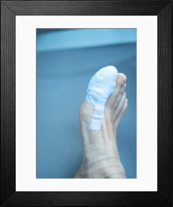 Framed Print : Foot big toe bandage injured feet in medical clinic hospital center Framed Print : Foot big toe bandage injured feet in medical clinic hospital center