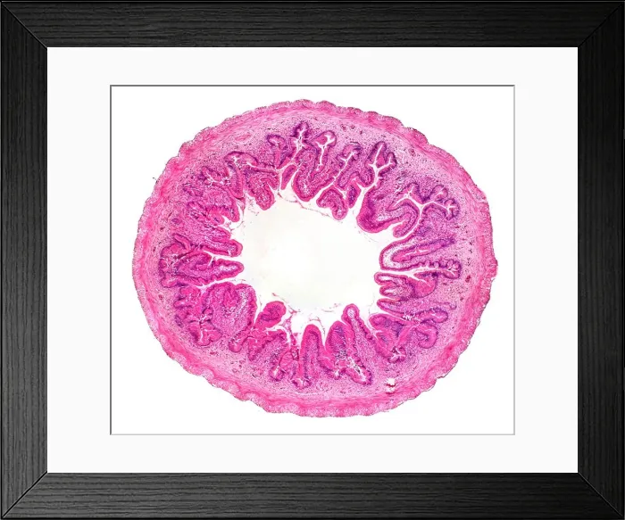 Framed Print : Frog small intestine TS showing villi nutrient absorption finger like projections Framed Print : Frog small intestine TS showing villi nutrient absorption finger like projections