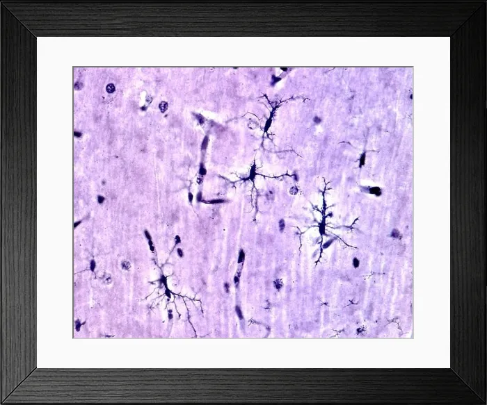 Framed Print : Microglia cells stained with Rio Hortega's silver carbonate method in the grey matter of the brain. This type is the ramified or resting microglia Framed Print : Microglia cells stained with Rio Hortega's silver carbonate method in the grey matter of the brain. This type is the ramified or resting microglia
