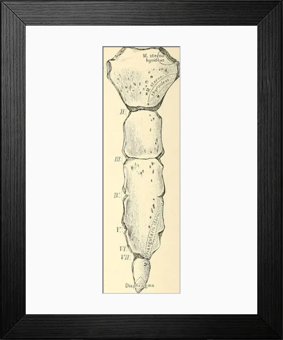 Framed Print : Die descriptive und topographische Anatomie des Menschen Framed Print : Die descriptive und topographische Anatomie des Menschen