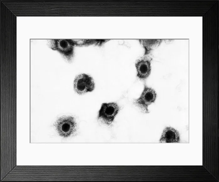 Framed Print : Transmission Electron Micrograph (TEM) shows a number of cytomegalovirus virions present in an unknown tissue sample Framed Print : Transmission Electron Micrograph (TEM) shows a number of cytomegalovirus virions present in an unknown tissue sample