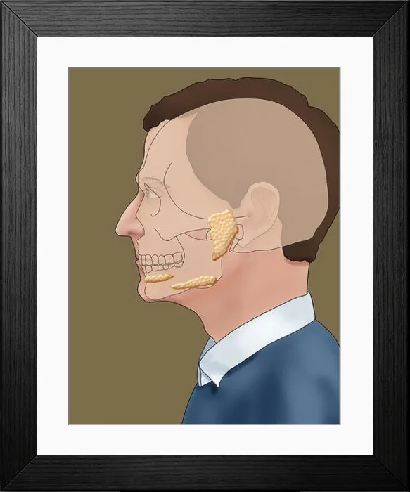 Framed Print : Illustration showing the location of the salivary glands in a male profile