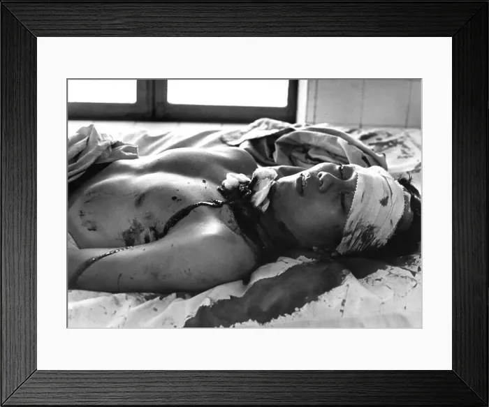 Framed Print : One of 48 persons wounded by a Viet Cong explosion which killed 14 persons in Saigon awaits treatment in the Cong Hoa Framed Print : One of 48 persons wounded by a Viet Cong explosion which killed 14 persons in Saigon awaits treatment in the Cong Hoa