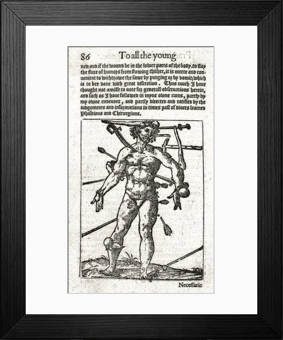 Framed Print : Wound-man illustration, 16th century, William Clowes Framed Print : Wound-man illustration, 16th century, William Clowes