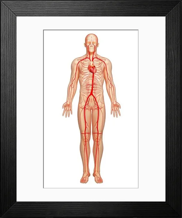 Framed Print : Human arteries, artwork Framed Print : Human arteries, artwork