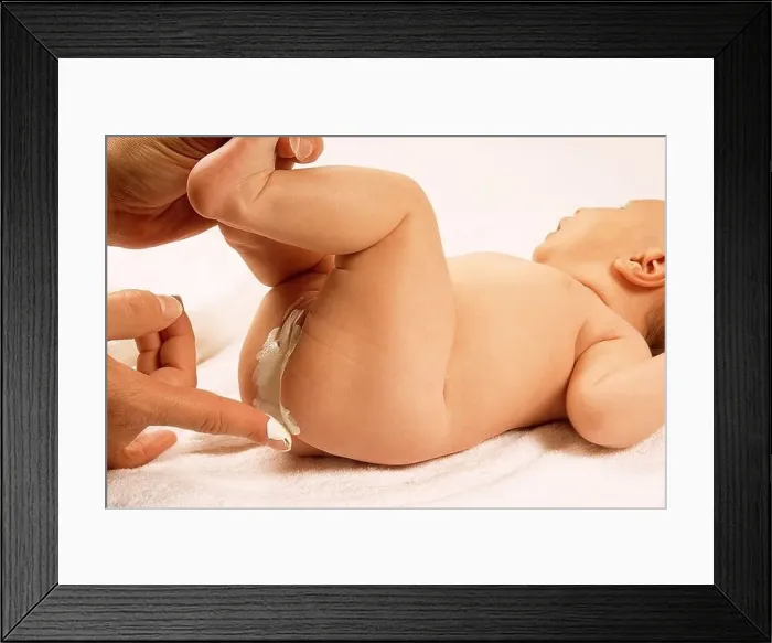 Framed Print : INFANT HYGIENE