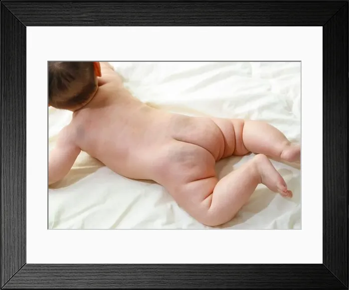 Framed Print : Baby, mongolian spots