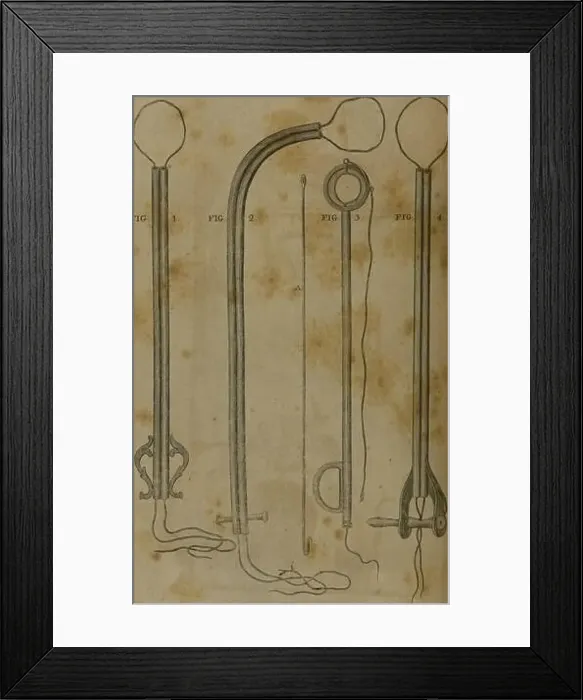 Framed Print : A system of surgery (Volume 4). PLATE XXXI TIG-. plate xxxn Framed Print : A system of surgery (Volume 4). PLATE XXXI TIG-. plate xxxn