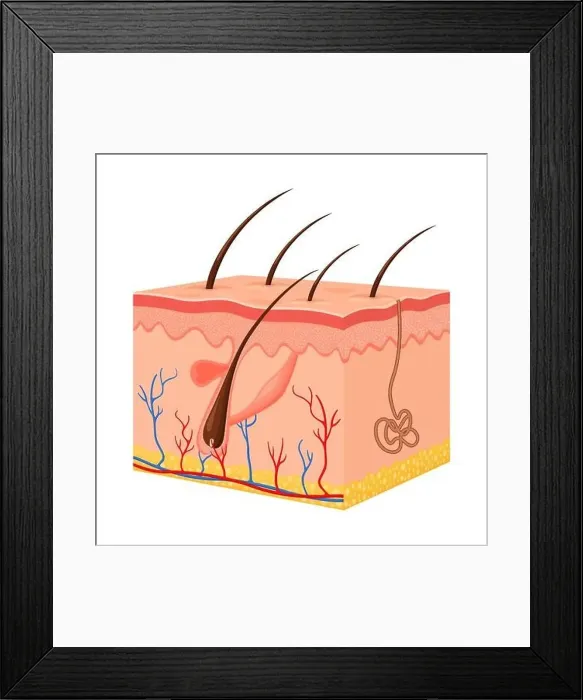 Framed Print : Human skin. Layered epidermis with hair follicle Framed Print : Human skin. Layered epidermis with hair follicle