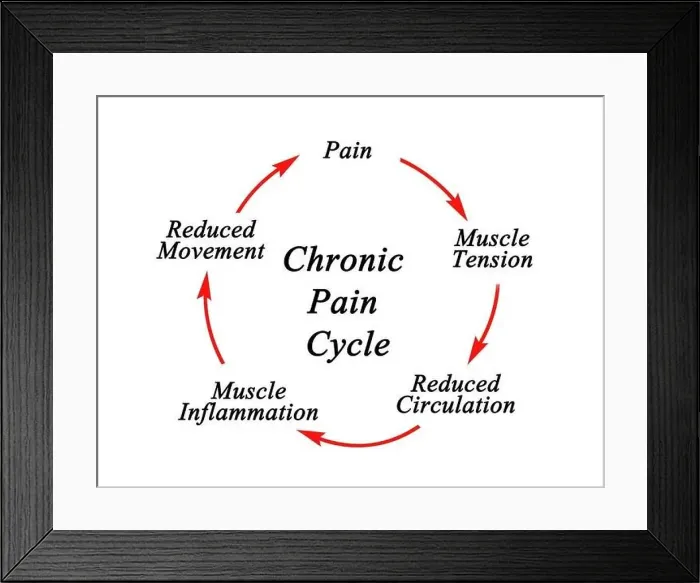Framed Print : Steps in Chronic Pain Cycle Framed Print : Steps in Chronic Pain Cycle