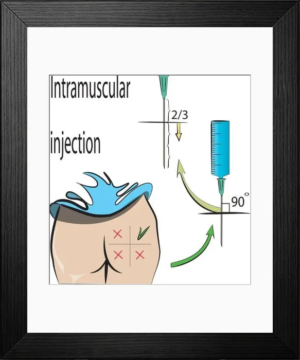 Framed Print : rules for intramuscular injection Framed Print : rules for intramuscular injection