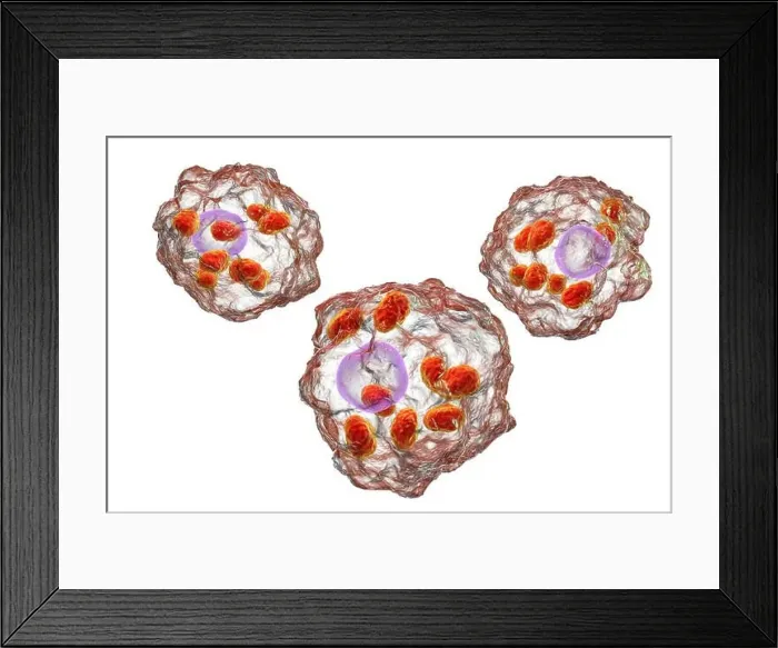 Framed Print : Amastigotes of Leishmania parasites inside macrophages Framed Print : Amastigotes of Leishmania parasites inside macrophages