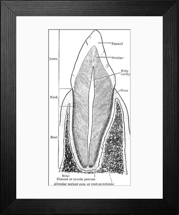 Framed Print : The vertical section of the canine tooth showing the various parts and structures Framed Print : The vertical section of the canine tooth showing the various parts and structures