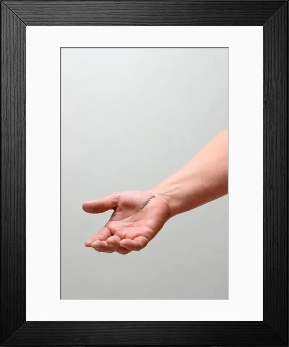 Framed Print : arm with stitches from carpal tunnel surgery Framed Print : arm with stitches from carpal tunnel surgery