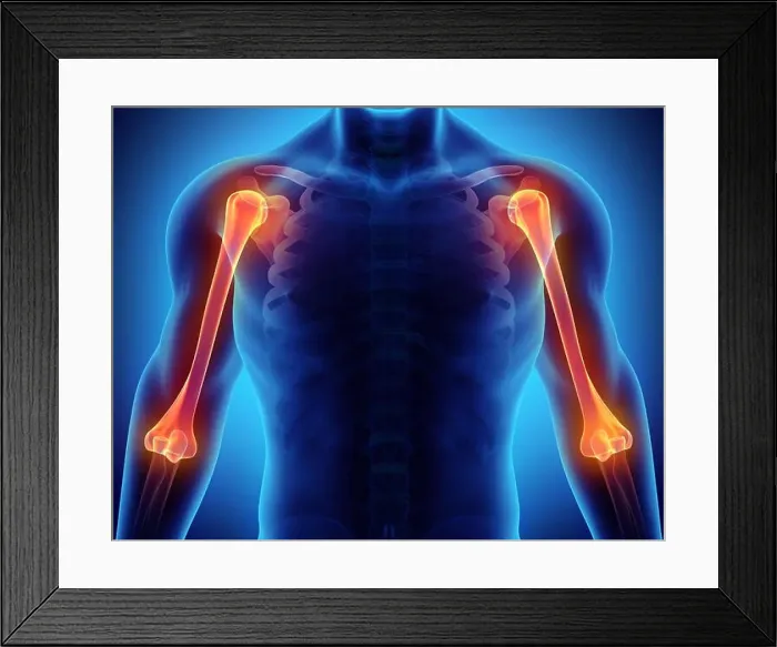 Framed Print : 3D illustration of Humerus - Part of Human Skeleton Framed Print : 3D illustration of Humerus - Part of Human Skeleton