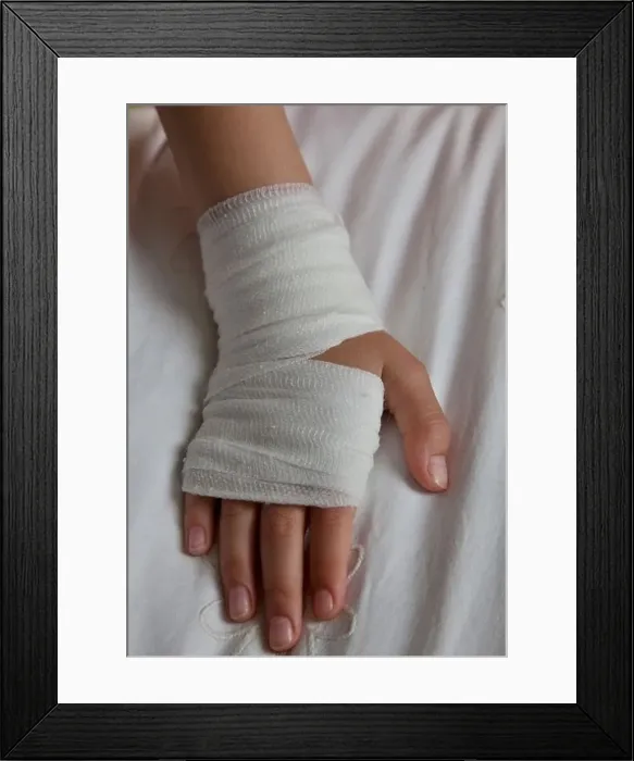 Framed Print : Young girl with bandaged hand Framed Print : Young girl with bandaged hand