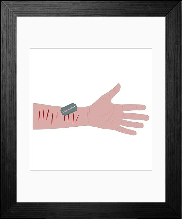 Framed Print : white man's hand with bleeding cuts and a blade. suicide attempt. white background isolated stock vector illustration Framed Print : white man's hand with bleeding cuts and a blade. suicide attempt. white background isolated stock vector illustration