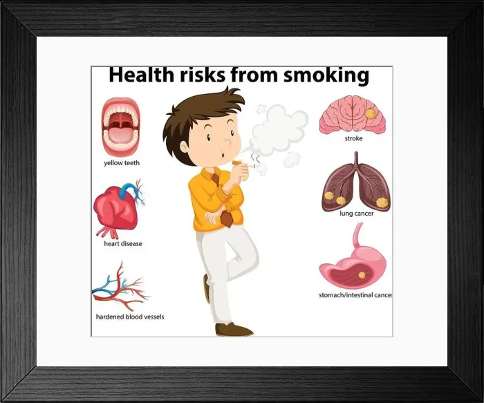 Framed Print : An Education Poster of Smoking and Health illustration Framed Print : An Education Poster of Smoking and Health illustration