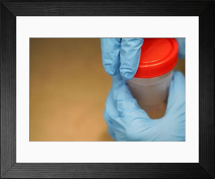 Framed Print : hands in nurse gloves collect a tube of stool for analysis in the laboratory Framed Print : hands in nurse gloves collect a tube of stool for analysis in the laboratory
