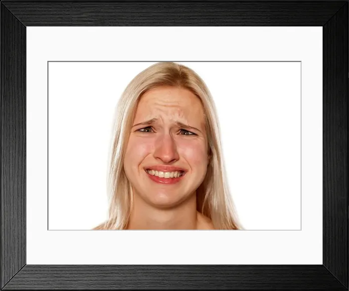 Framed Print : Young blonde with pimples on her forehead making a funny faces Framed Print : Young blonde with pimples on her forehead making a funny faces