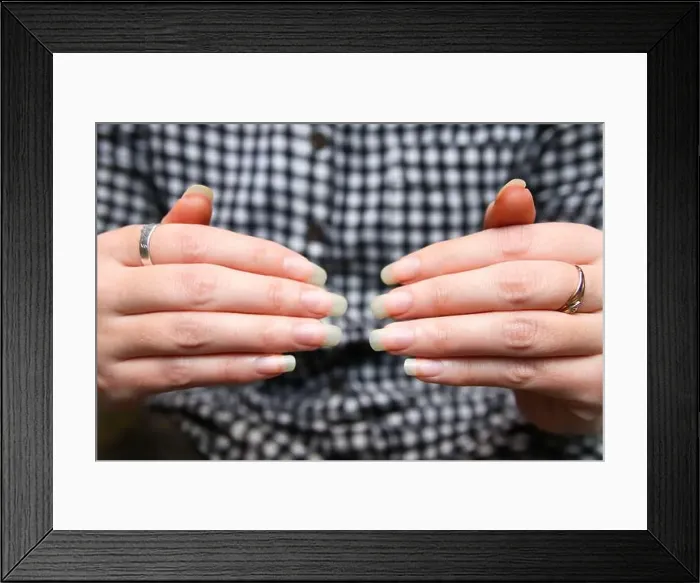 Framed Print : Female Hands. Closeup woman shows her natural nails without nail polish Framed Print : Female Hands. Closeup woman shows her natural nails without nail polish