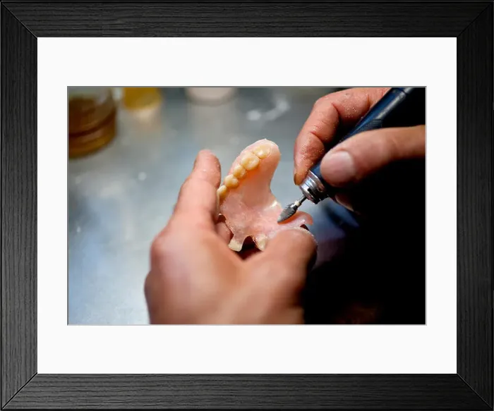 Framed Print : Repairing Artificial Human Teeth Framed Print : Repairing Artificial Human Teeth