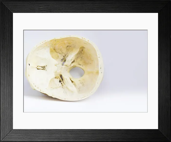Framed Print : top view of base of the human skull showing sphenoid bone and foramen magnum for anatomy in isolated white background Framed Print : top view of base of the human skull showing sphenoid bone and foramen magnum for anatomy in isolated white background