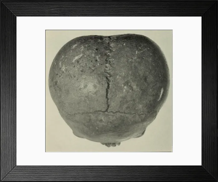 Framed Print : Bulletin. Ethnology. a. An asymmetrical skull Framed Print : Bulletin. Ethnology. a. An asymmetrical skull