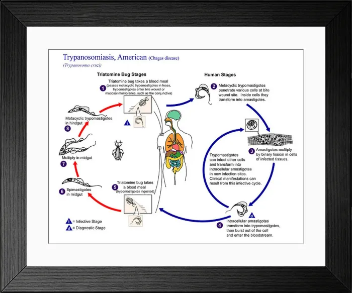 Framed Print : illustration depicting the life cycle of Trypanosoma cruzi the causal agent of American Trypanosomiasis Framed Print : illustration depicting the life cycle of Trypanosoma cruzi the causal agent of American Trypanosomiasis