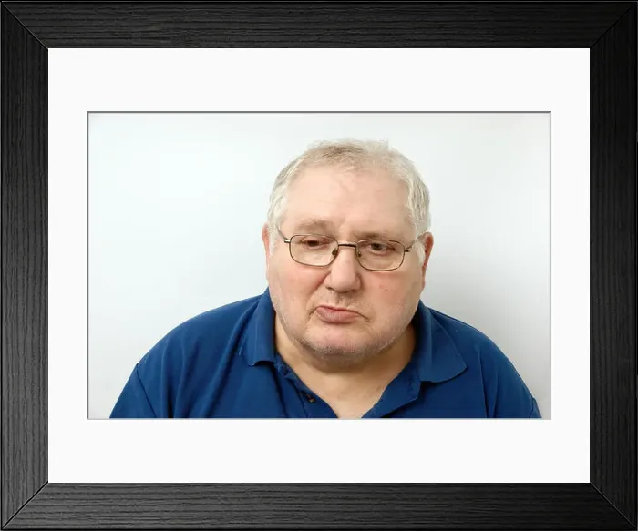 Framed Print : Elderly man suffering from Bell's Palsy Bell's palsy is a form of facial paralysis resulting from a dysfunction of Framed Print : Elderly man suffering from Bell's Palsy Bell's palsy is a form of facial paralysis resulting from a dysfunction of