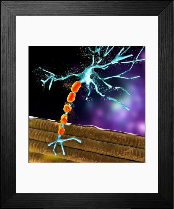 Framed Print : Degradation of motor neurons, conceptual computer illustration Framed Print : Degradation of motor neurons, conceptual computer illustration