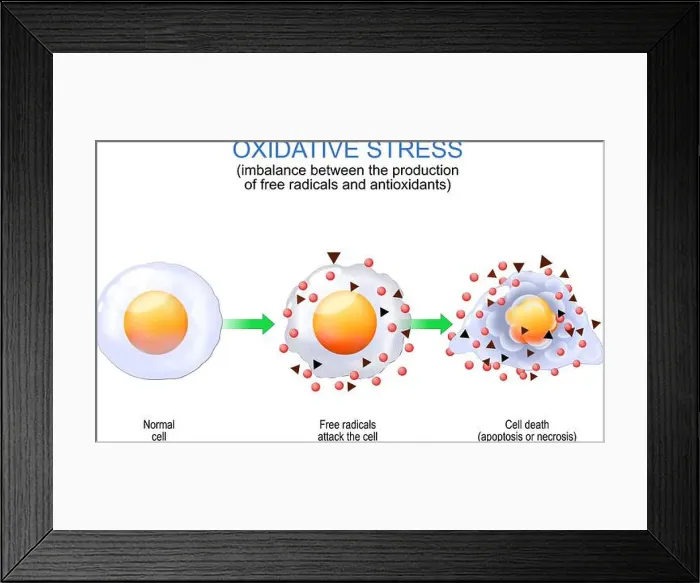 Framed Print : Oxidative stress. imbalance between the production of free radicals and antioxidants Framed Print : Oxidative stress. imbalance between the production of free radicals and antioxidants