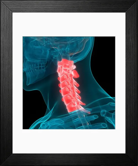 Framed Print : Human Skeleton System Vertebral Column Cervical Vertebrae Anatomy Framed Print : Human Skeleton System Vertebral Column Cervical Vertebrae Anatomy