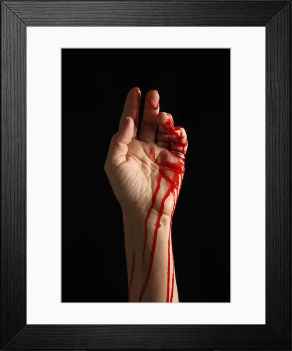 Framed Print : Bleeding hand Framed Print : Bleeding hand