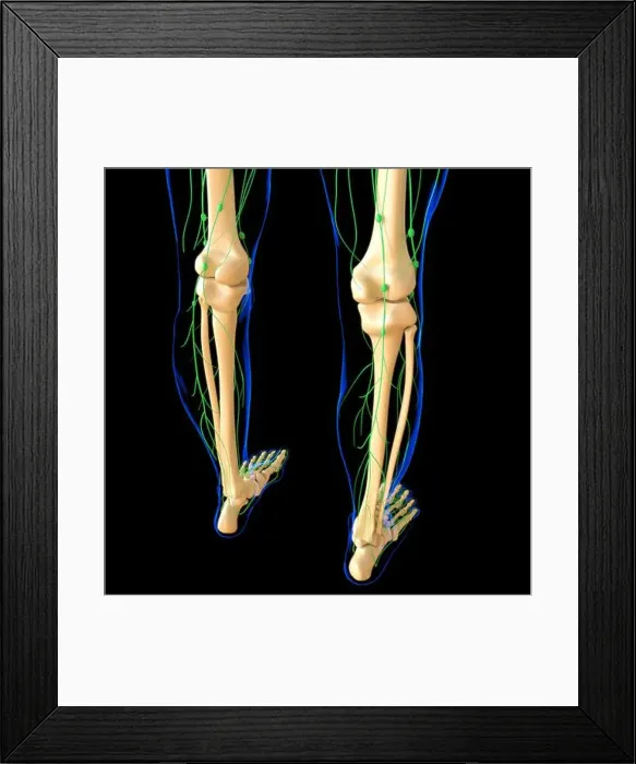 Framed Print : Human Lymph Nodes Anatomy For Medical Concept 3D Illustration Framed Print : Human Lymph Nodes Anatomy For Medical Concept 3D Illustration