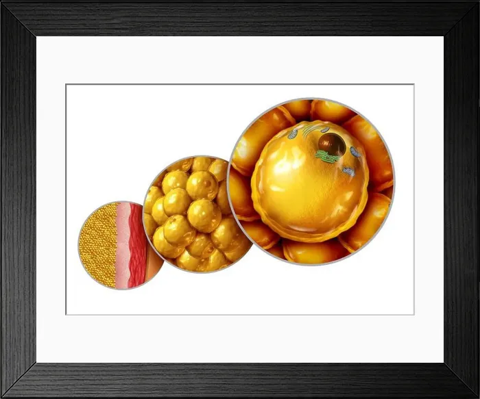 Framed Print : Fat cell anatomy and gaining weight or overweight Framed Print : Fat cell anatomy and gaining weight or overweight