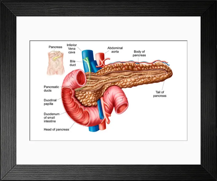 Framed Print : Anatomy of pancreas Framed Print : Anatomy of pancreas